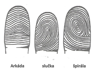 1 uvodna fotoZAKLADNÉ DERMATOGLYFY