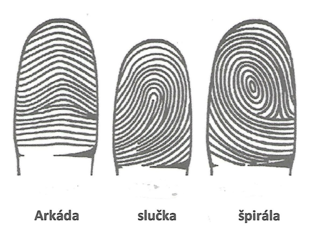 1 uvodna fotoZAKLADNÉ DERMATOGLYFY