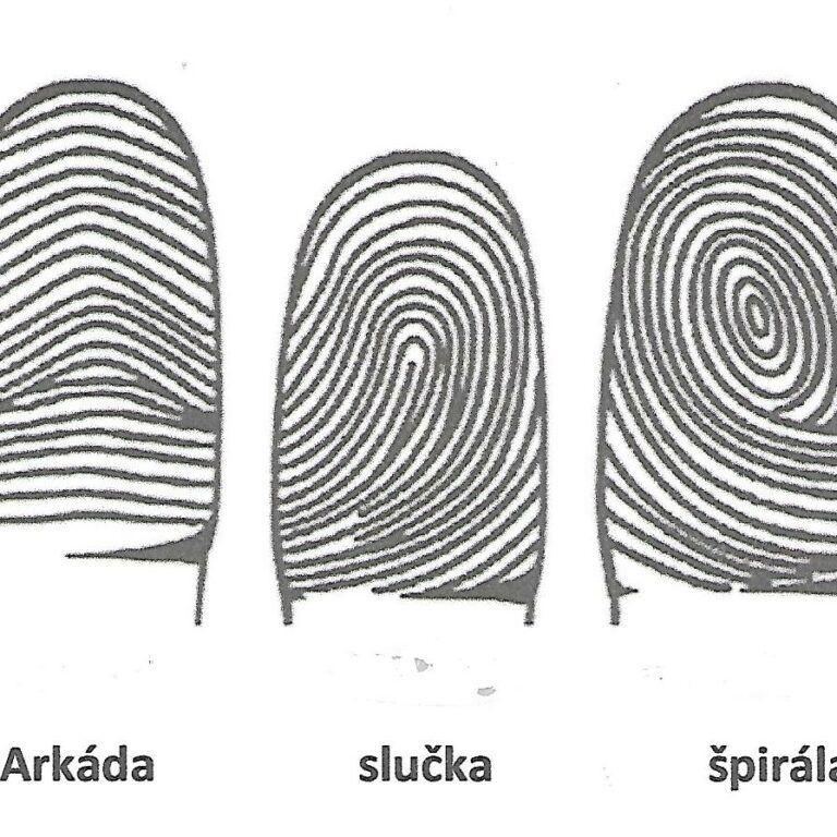 1 uvodna fotoZAKLADNÉ DERMATOGLYFY